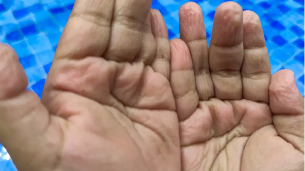 Parmakların Suda Buruşma Sırrı Çözüldü: Bilimsel Mekanizma Detaylarıyla Açıklandı
